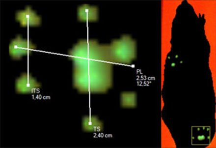 Interactive Footprints Measurements