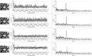 Danioscope cardiology graph